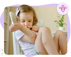 Insect bite sufferer
