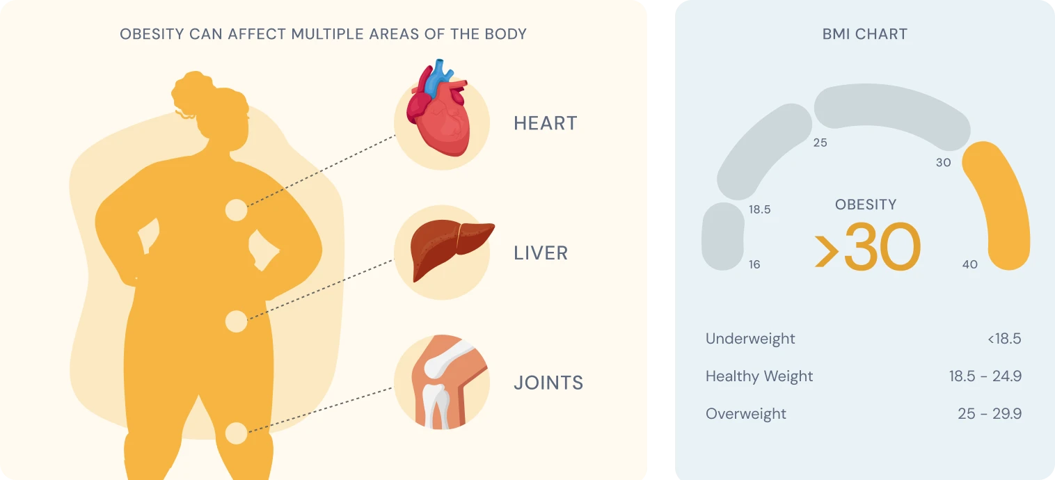 Obesity diagram of the heart, liver, and joints. BMI chart.
