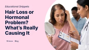 Managing Hormonal Hair Loss: Causes and Treatments - PillSorted Blog